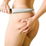 remoção-gordura-Fisest