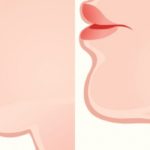 criolipolise-para-eliminar-a-papada